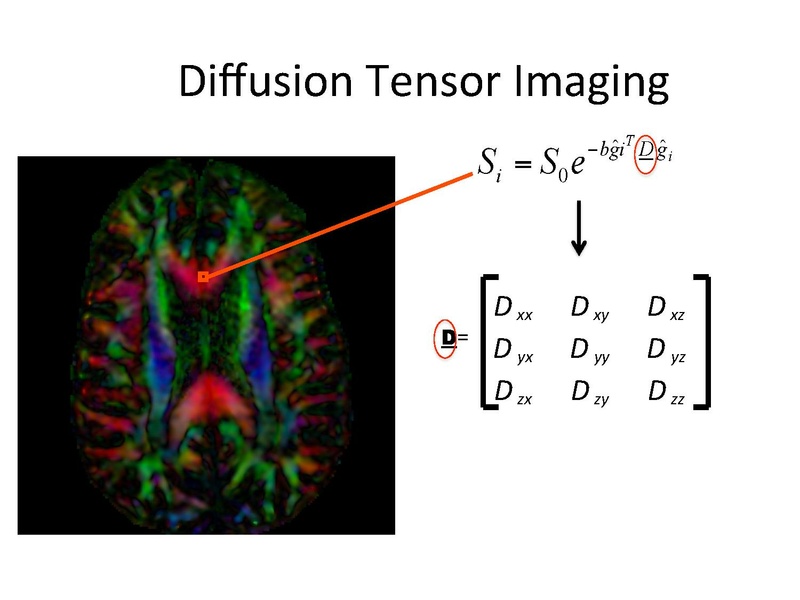 File:DiffusionMRIanalysisTutorial Slicer4.5 SoniaPujol.pdf