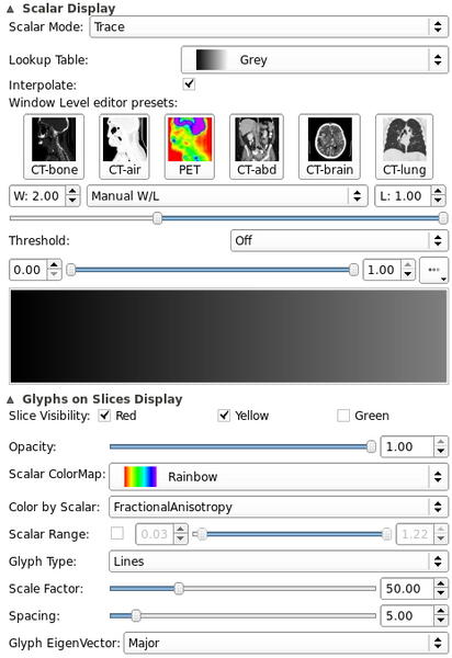 File:QSlicerDiffusionTensorVolumeDisplayWidget.png