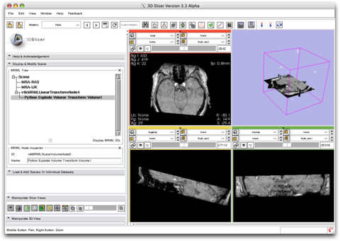 Modules:PythonExplodeVolumeTransform-Documentation-3.6 - Slicer Wiki