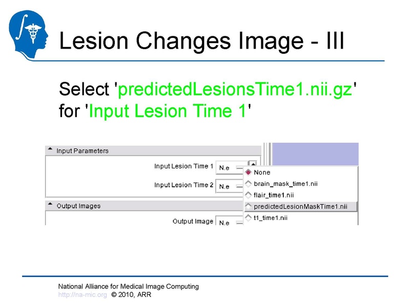 File:Longitudinal Lesion Comparison TutorialContest 2010.pdf