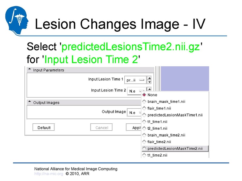 File:Longitudinal Lesion Comparison TutorialContest 2010.pdf