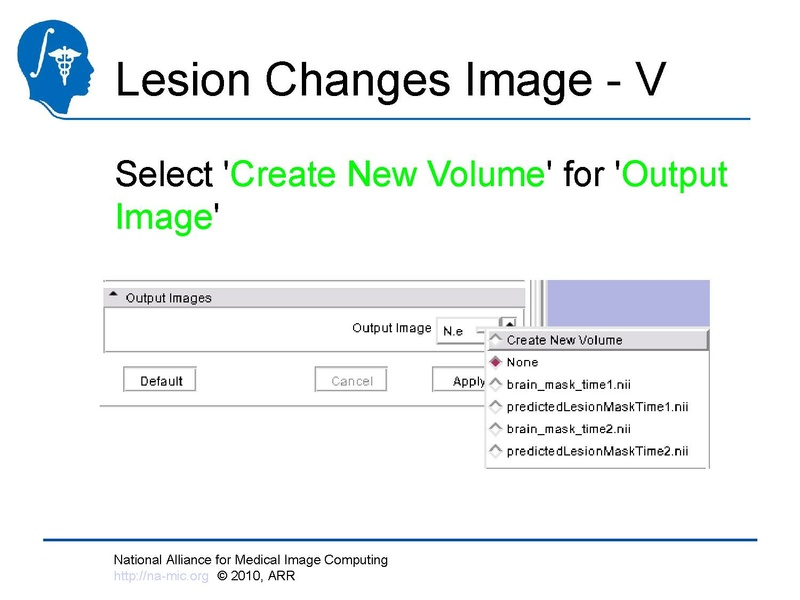 File:Longitudinal Lesion Comparison TutorialContest 2010.pdf