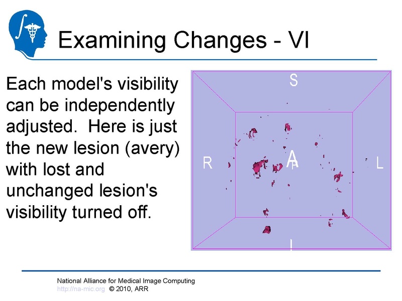 File:Longitudinal Lesion Comparison TutorialContest 2010.pdf