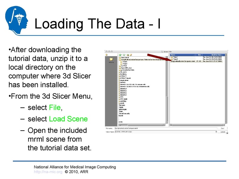 File:Longitudinal Lesion Comparison TutorialContest 2010.pdf