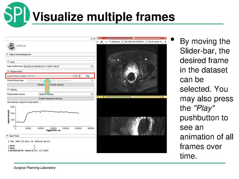 File:MultiVolumeExplorer Meysam SNR-April2013-v4.pdf