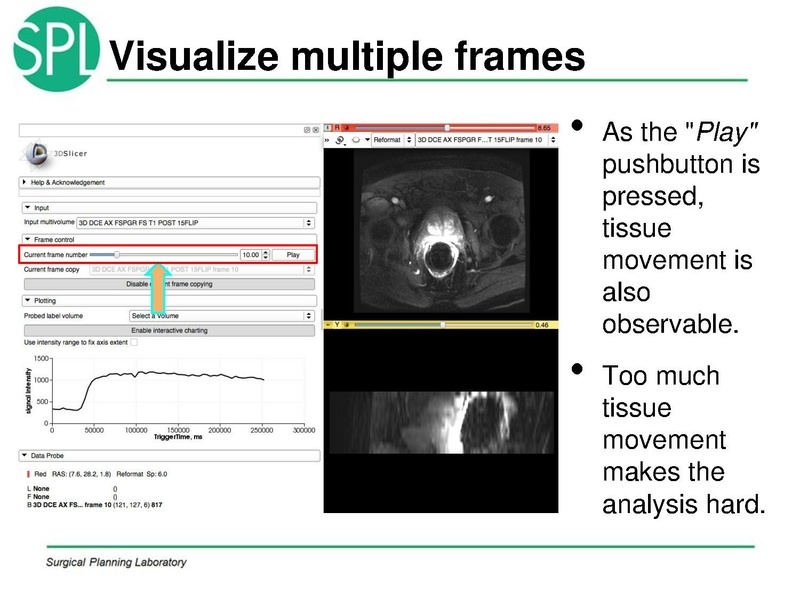 File:MultiVolumeExplorer Meysam SNR-April2013-v4.pdf