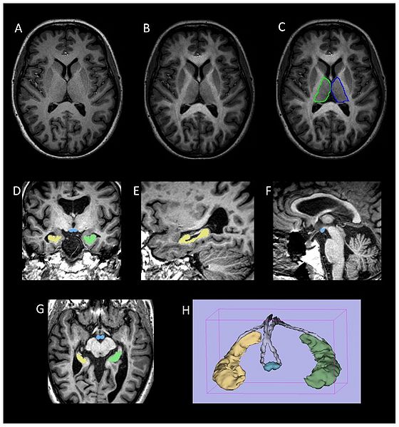 File:Dineen-PLoSOne2012-fig1.jpg