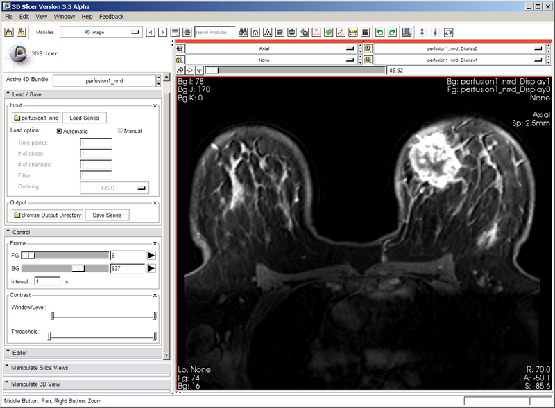 File:BCAnalysis Perfusion1.png
