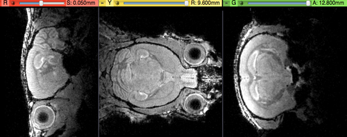 original brain in non-RAS orientation