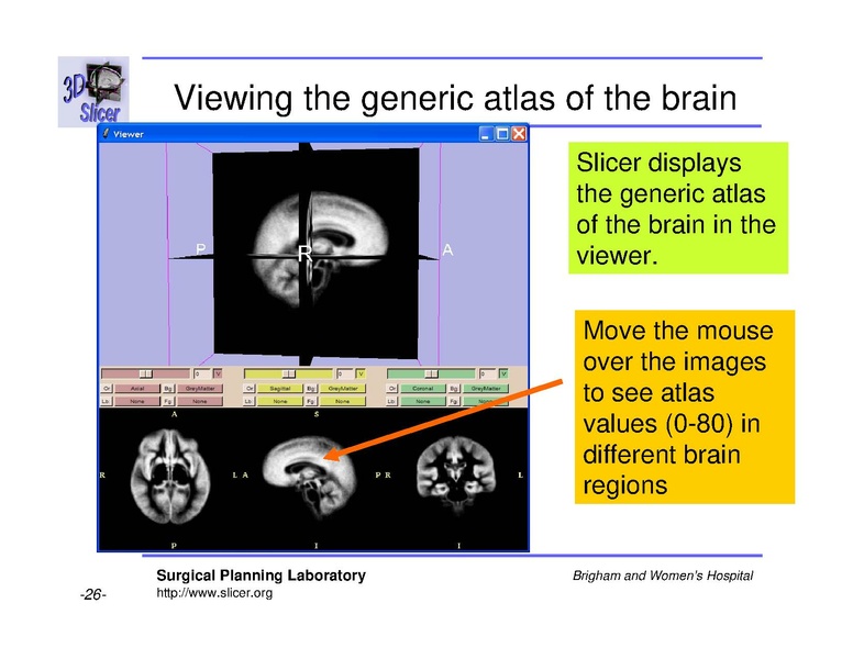 File:Slicer 2.6 page EMAtlasBrainClassifier.pdf