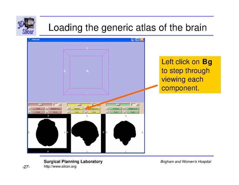 File:Slicer 2.6 page EMAtlasBrainClassifier.pdf