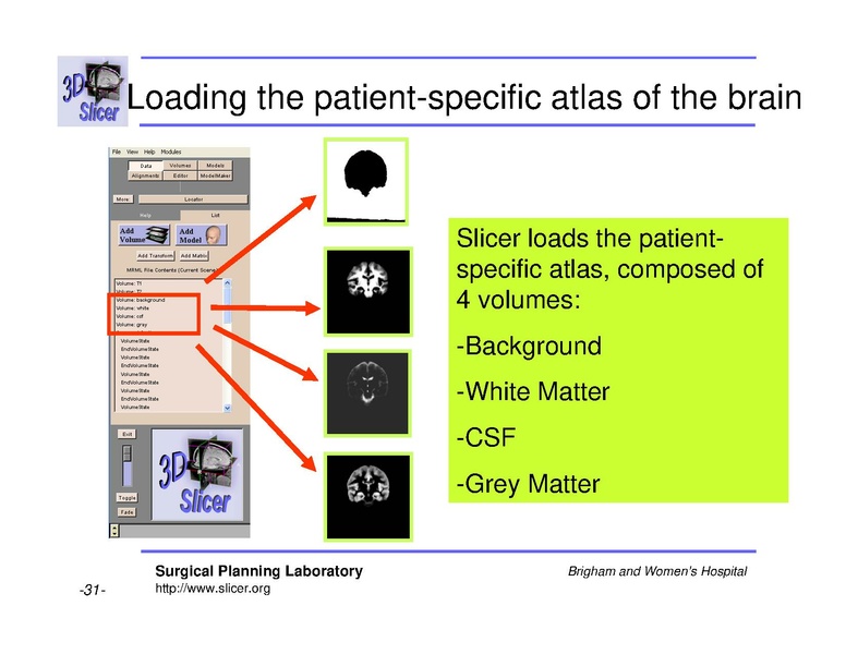 File:Slicer 2.6 page EMAtlasBrainClassifier.pdf