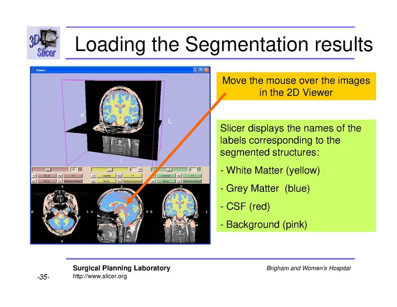 File:Slicer 2.6 page EMAtlasBrainClassifier.pdf