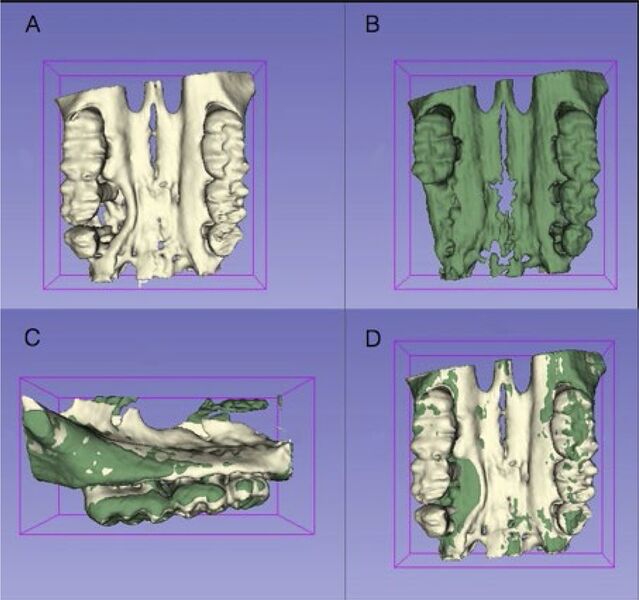 File:Oz-Orthod Craniofac Res. 2019-fig3.jpg