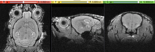 original brain in proper RAS orientation