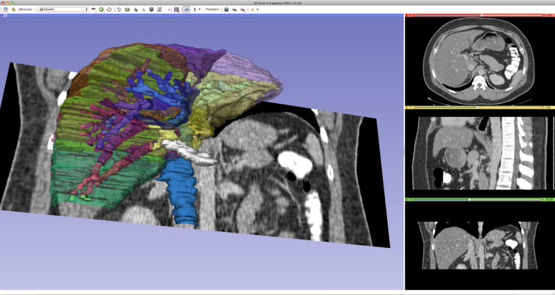 File:Slicer4RSNA 2.png