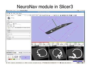 Slicer igt img6.jpg