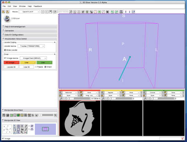 Slicer3 OpenIGTLinkIF ImagePlaneSetting3.png
