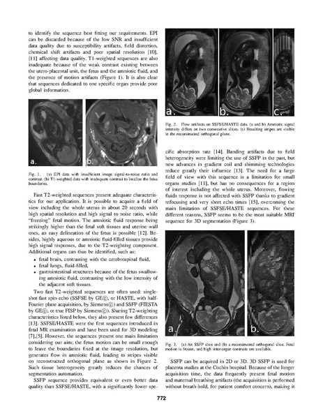 File:Anquez-EMBS2007.pdf