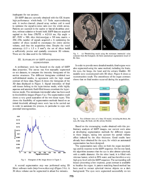 File:Anquez-EMBS2007.pdf