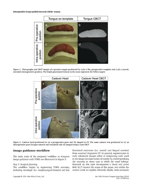 File:Liu-IntJMedRobot2014.pdf