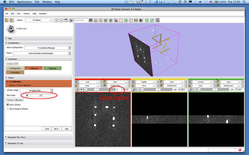 File:Slicer3 ProstateNav CheckZFrameSliceRange.png