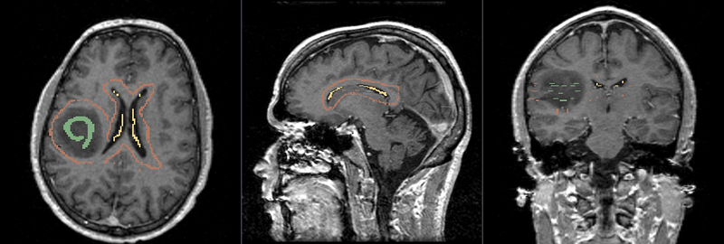 File:FGC Brain Seed.png