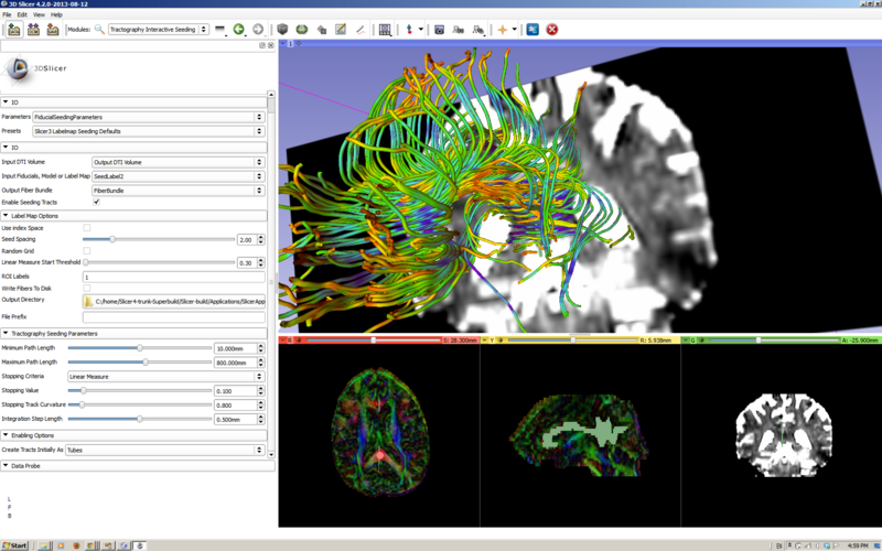 File:Tractography LabelMap Seeding.PNG