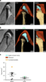 Kuchler-Bopp-Int J Oral Sci. 2020-fig3.gif