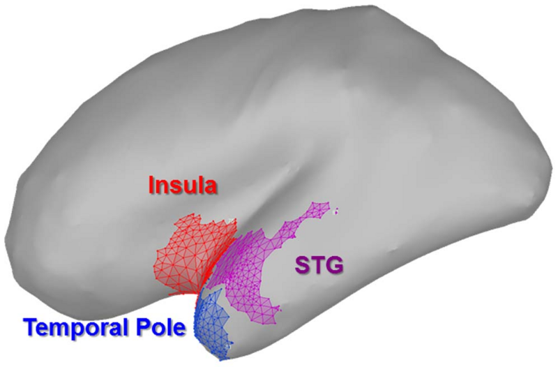 File:Balderston-PLoSOne2014-fig.png