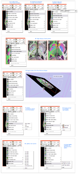 File:Slicer36-SliceGUIMoreMap.png