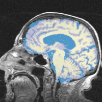 EMS Quantitative assessment.png