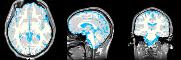 MRI-Human-Brain-Labelmap.png