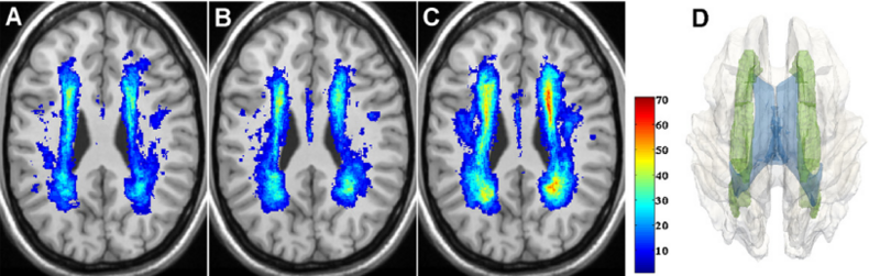 File:Moscufo-NeurobiolAging2009-fig2.png