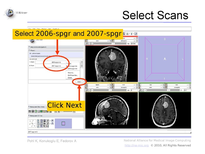 File:Slicer3.6-ChangeTrackerTutorial.pdf