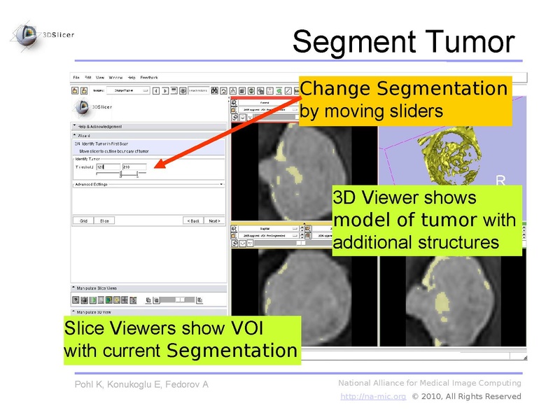 File:Slicer3.6-ChangeTrackerTutorial.pdf