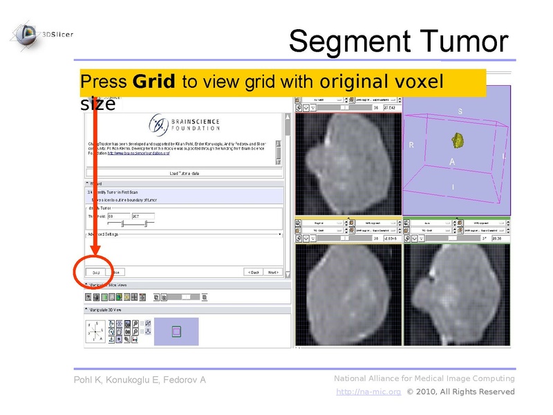 File:Slicer3.6-ChangeTrackerTutorial.pdf