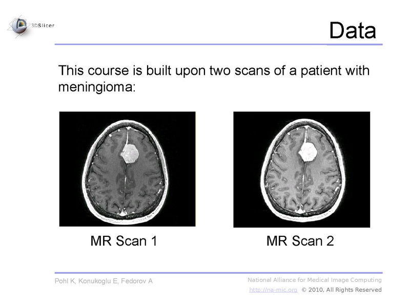 File:Slicer3.6-ChangeTrackerTutorial.pdf