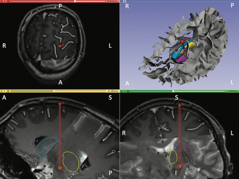 File:Baumgarten-IEEE TBE2017.png