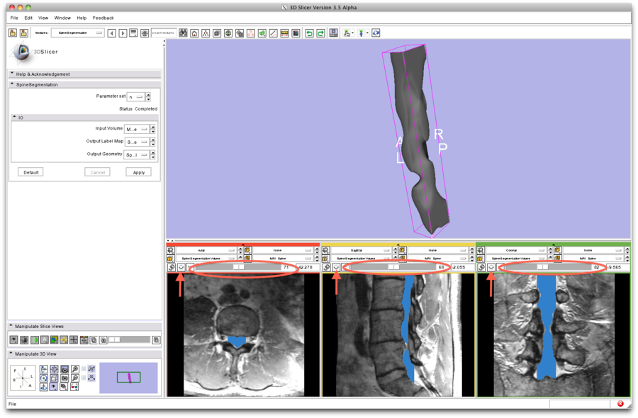Modules:SpineSegmentation-Documentation-3.6 - Slicer Wiki