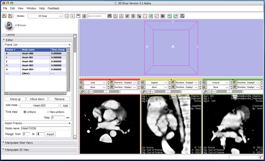 Modules:FourDImage-Documentation-3.6 - Slicer Wiki