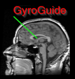 GyroGuide.png