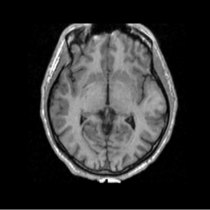 EMSegmenter MRI-Human-Brain Template 420x420.png