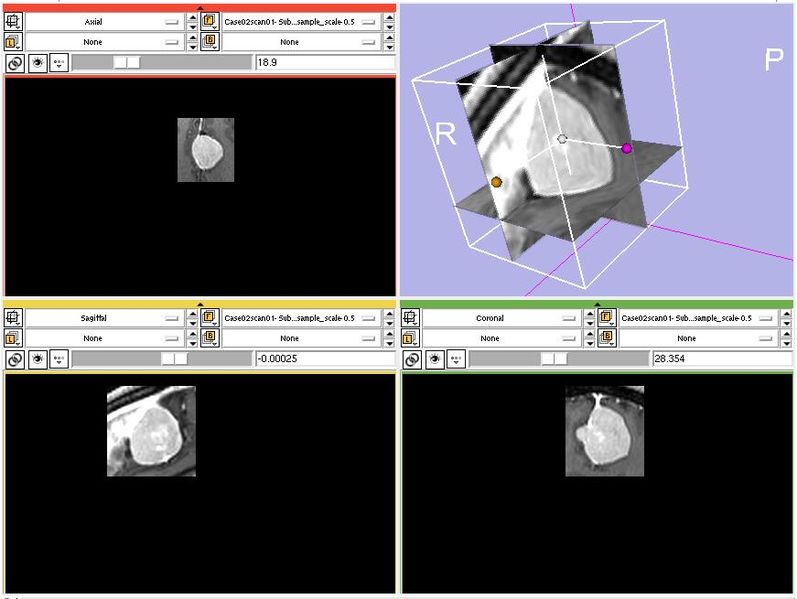 File:ExtractSubvolume2.png