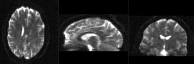 RegLib C32 RegisteredAffine.gif