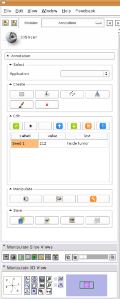 File:2010-SlicerAM QtAnnotation.png