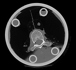 this is the fixed reference image. All images are aligned into this space