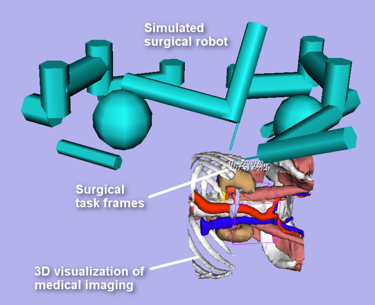 File:Automated port placement surgical plan.png