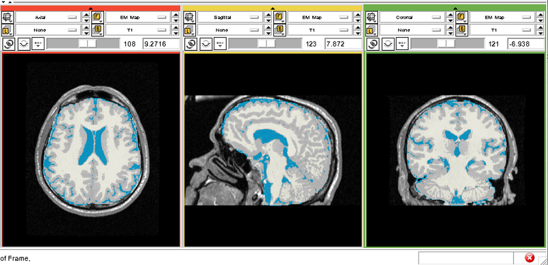 File:EMS HIVStudy Segmentation.png