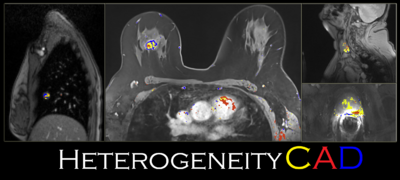 HeterogeneityCAD.PNG